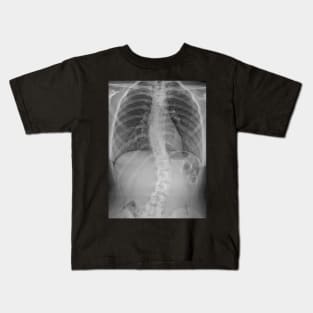 Scoliosis Xray Kids T-Shirt